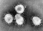 An image of the bronchitis virus, part of the coronavirus family that includes the common cold, SARS and MERS. They have a halo, or crown-like (corona) appearance when viewed under an electron microscope. Photo: CDC/Public domain