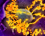 A scanning electron microscope image of the Covid-19 (SARS-CoV-2) coronavirus (round gold objects), emerging from the surface of cells cultured in the lab. Photo: CNS/NIAID-RML via Reuters