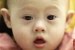 A file photo of a baby born with Down Syndrome. Photo: CNS/Reuters